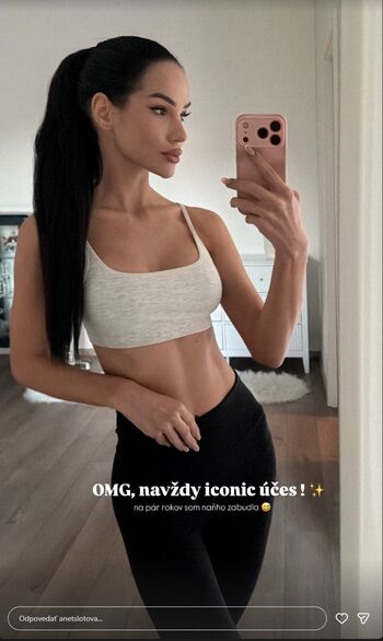 Anet slotova page leaked private photo uncensored HD quality