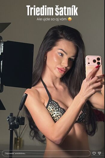 Anet slotova page leaked private photo uncensored HD quality