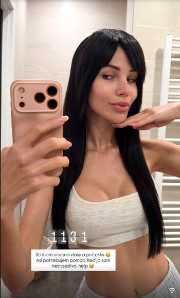 Anet slotova page leaked private photo uncensored HD quality