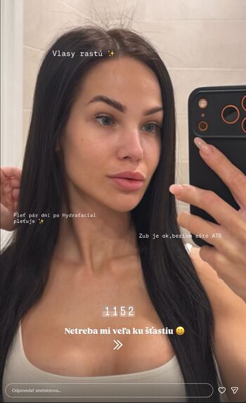 Anet slotova leaked private photo uncensored HD quality