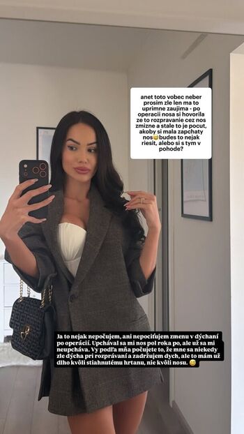 Anet slotova leaked private photo uncensored HD quality