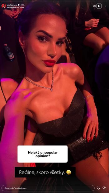 Anet slotova leaked private photo uncensored HD quality