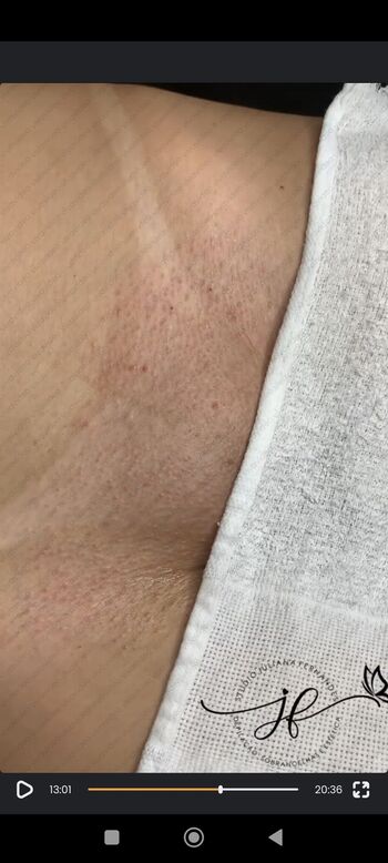 Bronzeamento natural page leaked private photo uncensored HD quality