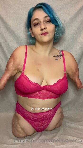 Disabled girls page leaked private photo uncensored HD quality