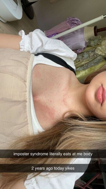 Ester dobrik page leaked private photo uncensored HD quality