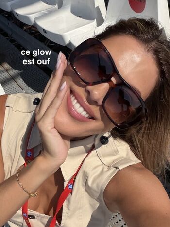 Iris mittenaere  page leaked private photo uncensored HD quality
